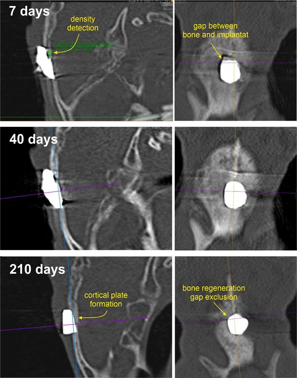 Figure 2. Computed tomography of the skull of a rabbit with a bioceramic implant in the defect zone on days 7, 40, and 210 after surgery.