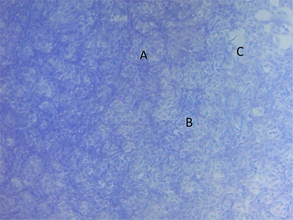 Figure 2. Photomicrograph of MCF-7DOX cells: photobiomodulation without doxorubicin. Growth of tumor cells in the form of a mesh structure with thinning (A); individual anastomoses involving cell processes (B); ruptures of a solid layer of tumor cells with the formation of niches (C).