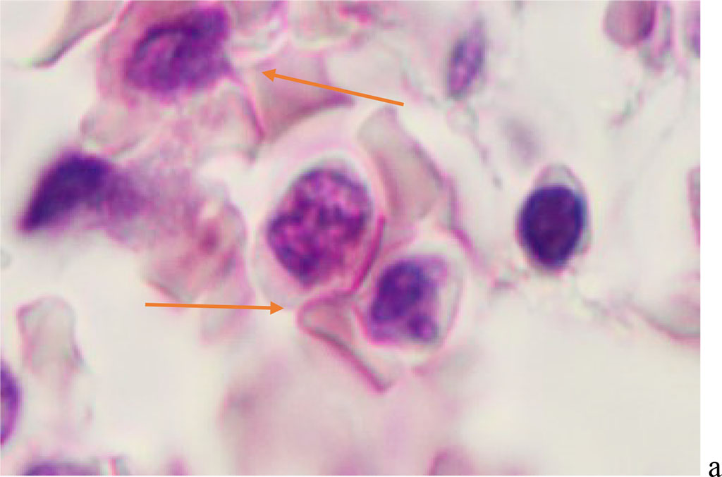 Figure 1 - Red bone marrow. Stained with hematoxylin and eosin. Magnification x 400.