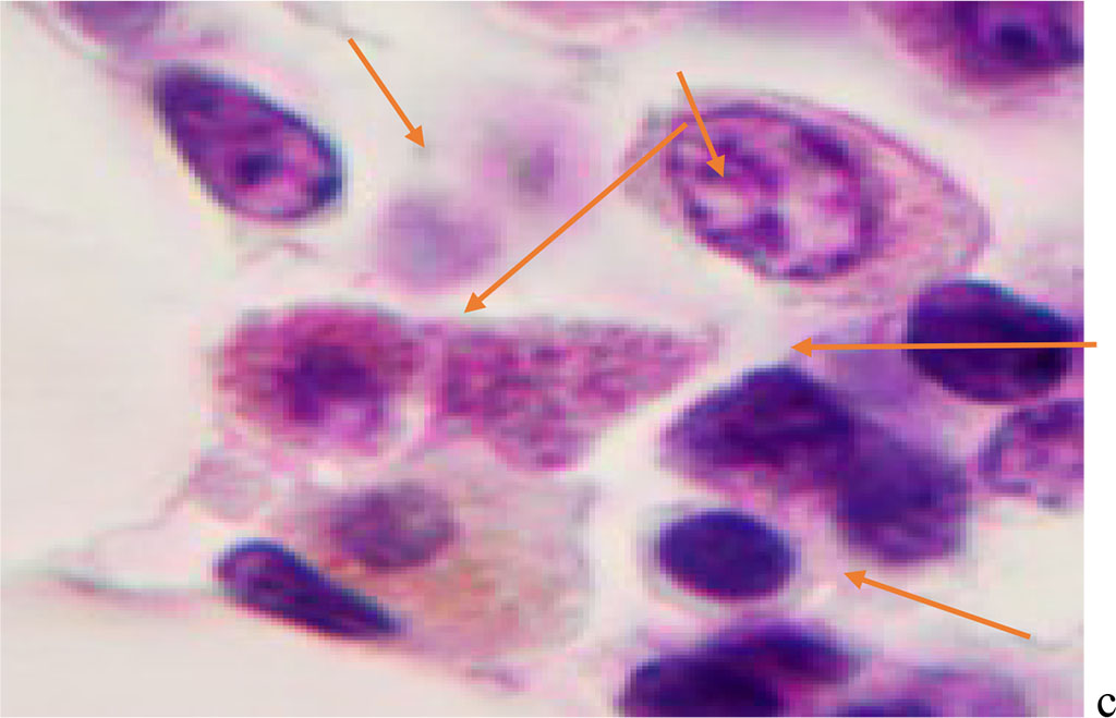 Figure 1 - Red bone marrow. Stained with hematoxylin and eosin. Magnification x 400.