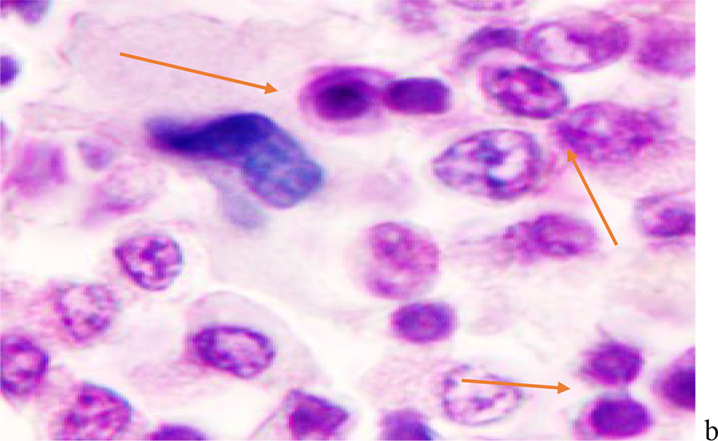Figure 2 - Red bone marrow. Stained with hematoxylin and eosin. Magnification x 400.