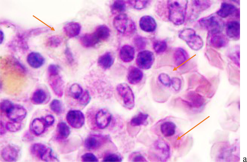 Figure 3 - Red bone marrow. Stained with hematoxylin and eosin. Magnification x 400.