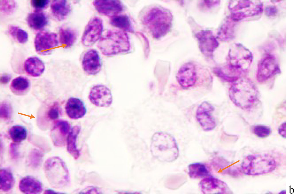 Figure 3 - Red bone marrow. Stained with hematoxylin and eosin. Magnification x 400.