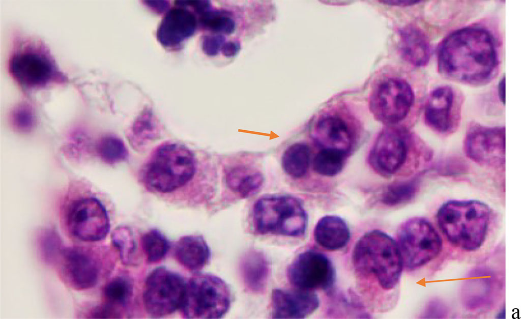 Figure 4 - Red bone marrow. Stained with hematoxylin and eosin. Magnification x 400.