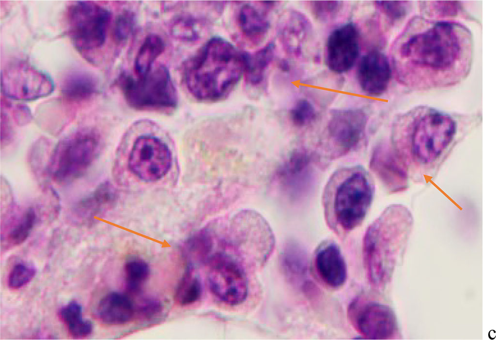 Figure 5 - Red bone marrow. Stained with hematoxylin and eosin. Magnification x 400.