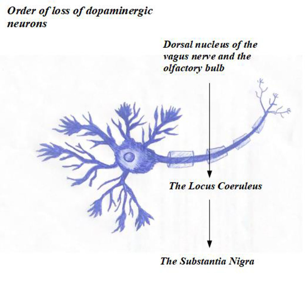Order of loss of fopaminergic neurons