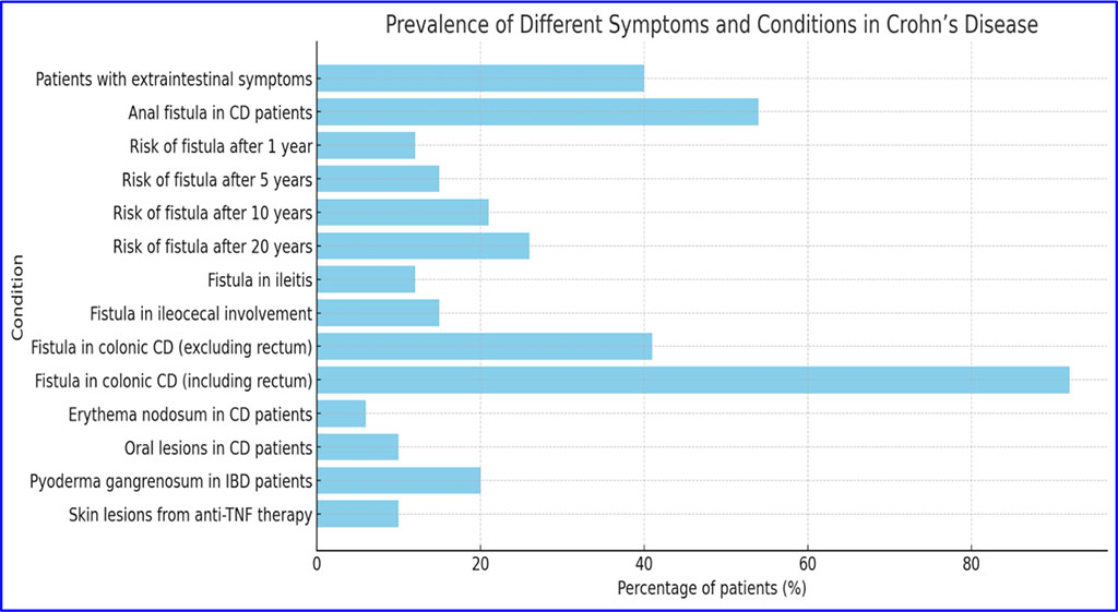 Crohn's disease (CD)