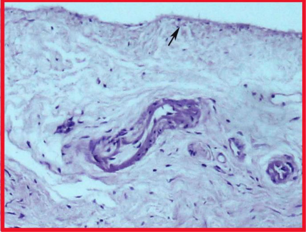 Fig. 1a. Highlighted area in Fig. 1. Fibers interwoven into the periosteum (highlighted by the arrow).