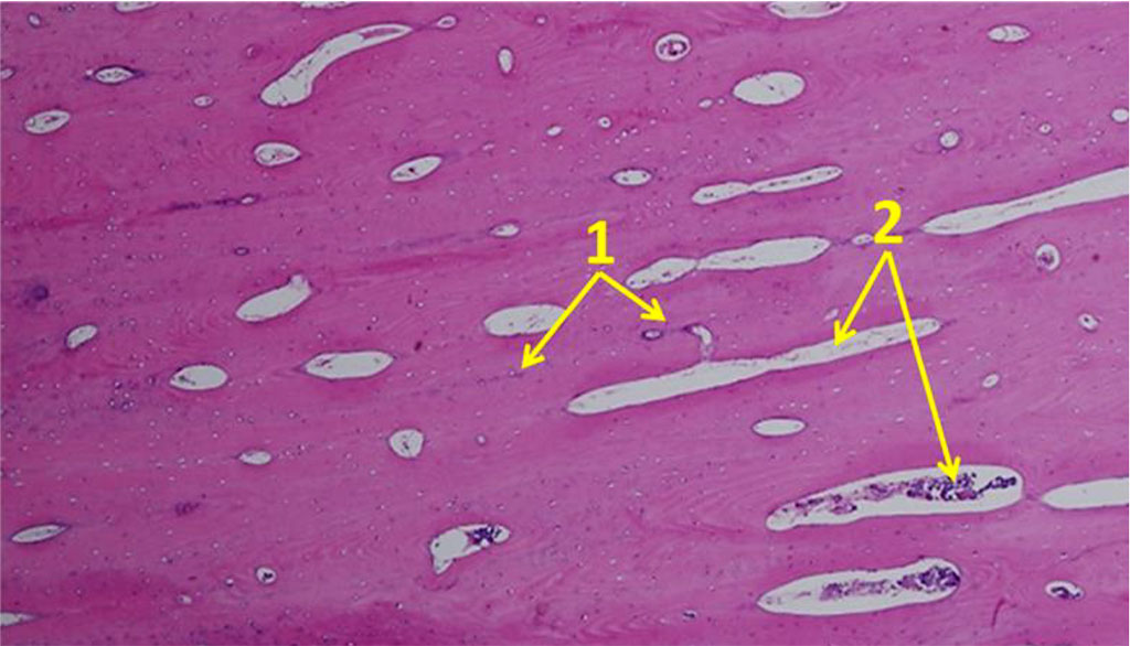 Figure 10. Orientation of osteocytes in relation to the Haversian canals on histological preparations of the intact bone from the chin symphysis area (×100; hematoxylin-eosin staining; 1– osteocytes; 2 – Haversian canals).