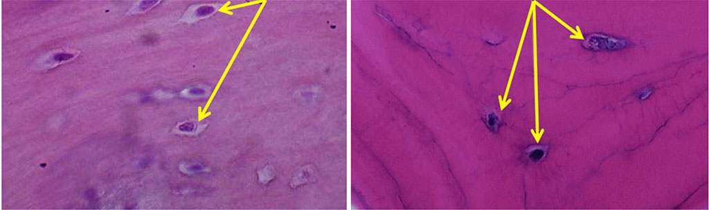 Figure 9. Osteocytes on histological preparations of the intact bone from the chin symphysis area (a) and from the outer oblique line area (b); (×800, hematoxylin-eosin stain).