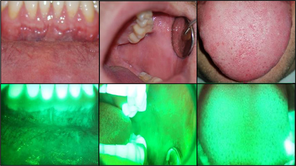 Fig. 1a Normal oral mucosa