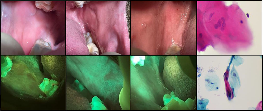 Fig. 2a The mucous membrane of the mouth without visible pathological changes