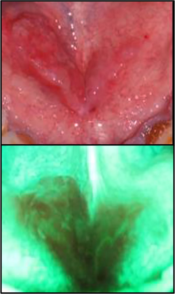 Fig 6a Oncology of the floor of the mouth 