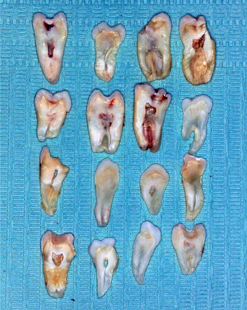 Fig. 1. Plates made from extracted teeth.