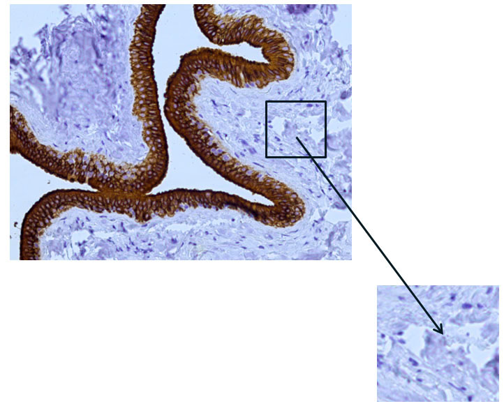 Fig. 10 The excretory duct of the salivary gland. Indirect immunoperoxidase method with antibodies to CK7, x 200. Absence of cytokeratin 7 (CK7) expression in other cells.