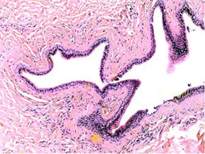 Fig. 3a The excretory duct of the salivary gland. Staining with hematoxylin and eosin – x 60	Fig. 