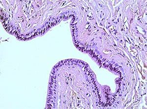 Fig. 3c into the excretory duct of the salivary gland. Staining with hematoxylin and eosin – x 250	fig.