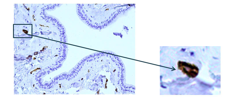Fig. 4 The excretory duct of the salivary gland. Indirect immunoperoxidase method with antibodies to α-SMA, x 200.Pronounced expression of α-SMA (alpha-smooth muscle actin) in the cells of the walls of various vessels.