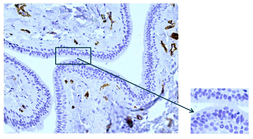 Fig. 5 The excretory duct of the salivary gland. Indirect immunoperoxidase method with antibodies to α-SMA, x 200.Lack of expression in the cells of the excretory duct wall.