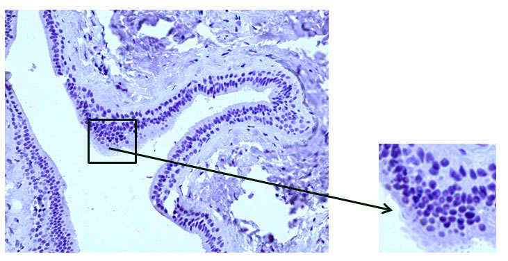 Fig. 8 The excretory duct of the salivary gland. Indirect immunoperoxidase method with antibodies to desmin, x 200. Absence of desmin expression in duct wall cells.