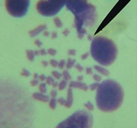 Figure 3. Cytogenetic disturbances detected on day 30 after incorporation of Tc (Group II) with activity of 15.78 mCi (polyploid cell (a), deletion (b), fragment (c)).
