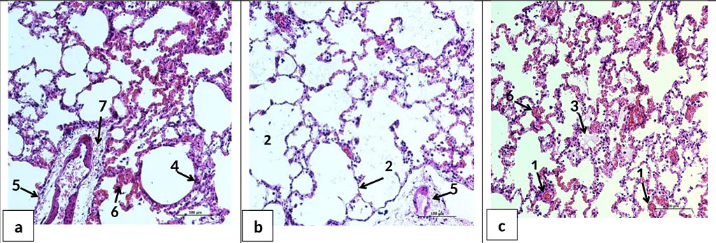 Figure 5. Microphotographs of lung sections 24 hours after HS and reperfusion. a, b, c - parts of the lungs of animals of HS+BES group. Full blood pulmonary vessels (1); thinning of interalveolar septa, emphysema (2); edematous fluid in the alveoli (3), dystelectas (4), perivascular edema (5), hemorrhages in the alveoli and interalveolar septa (6), inflammatory/leukocyte cell infiltration into the perivascular space of vessels (7). H&E staining. Ob. ×20.