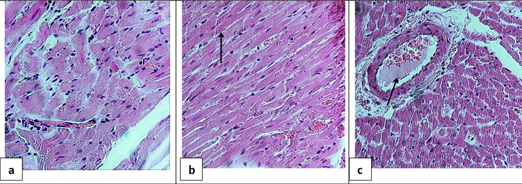 Figure 7. Microphotograph of the heart sections 24 hours after acute HS and reperfusion. a - area of compression and compaction of muscle fibers; b - fragmentation of Z-disks (marked with an arrow); c - sludge in a vessel (marked with an arrow). H&E staining. Ob. ×40