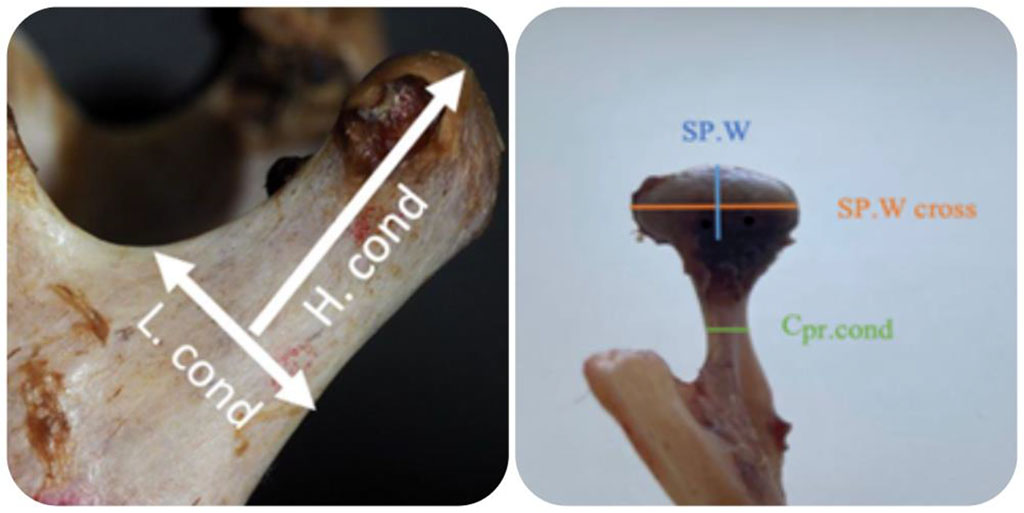 Figure 1. Measurement methodology: H.cond - height of the condylar process; L.cond – length of the base of the condylar process; Cpr.cond – thickness of the base of the condylar process; SP.W is the width of the condylar process in the sagittal section; SP.Wcross transversely is the width of the condylar process in cross section.