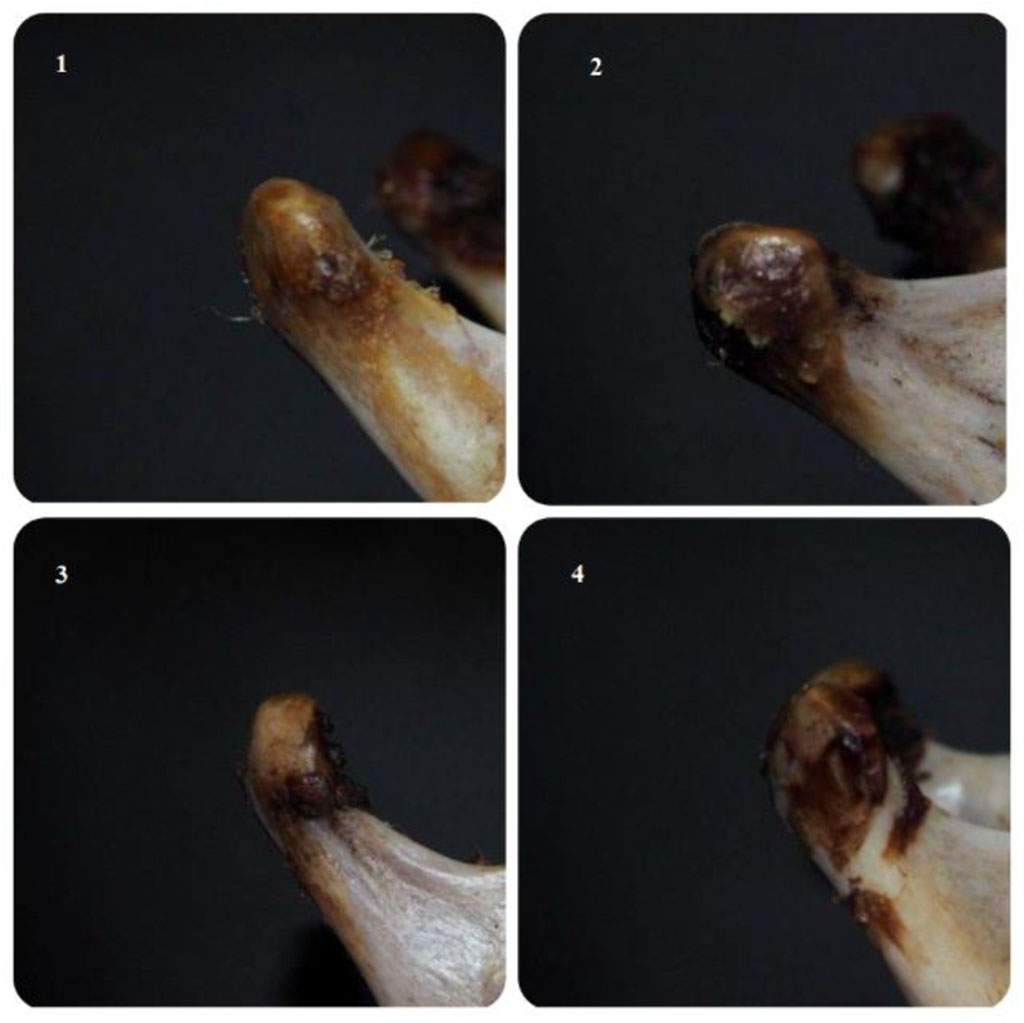 Figure 2. The shapes of the condylar processes of the lower jaw. 1. The condylar process has an oval shape; 2. The condylar process has a diamond–shaped shape; 3. The condylar process has the shape of a hook; 4. The condylar process has an L-shaped shape.
