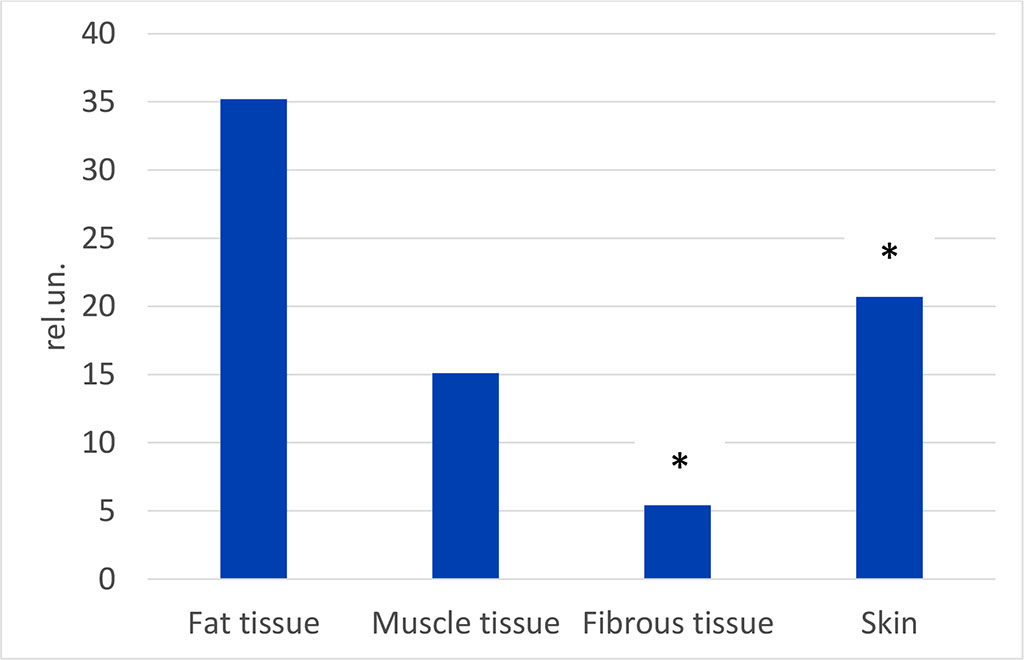 Figure 2. The level of dielectric permittivity of biological samples of different tissues («*» - difference to fat tissue is statisitcally valied, p<0.05)