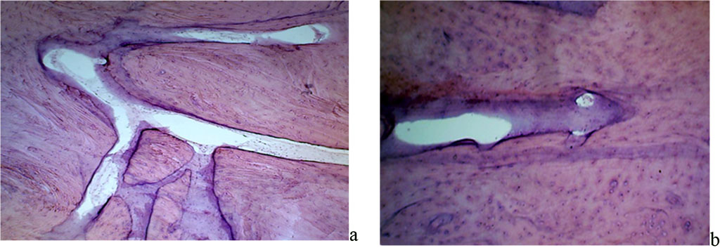 Figure 14. Angioarchitectonics of the maxillary alveolar process in the distal part with preserved dentition: a –the microcirculatory bed vessels, net-shaped, in the projection of the 26th tooth (×400, hematoxylin-eosin staining); b – the microcirculatory bed vessels, running parallel to the bone beams in the projection of the 26th tooth (×800, hematoxylin-eosin staining).
