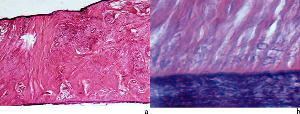 Figure 15. Periodontal ligament of the maxillary segment of the first molar: a – dense fibrous connective tissue (×400, hematoxylin-eosin staining); b – zone of dense fibrous connective tissue penetrating cement (×1000, hematoxylin-eosin staining).