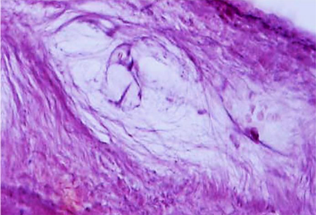 Figure 16. Periodontal ligament of the maxillary medial incisor dentoalveolar segment. Loose fibrous unformed connective tissue and periodontal cellular elements (×1000, hematoxylin-eosin stain).