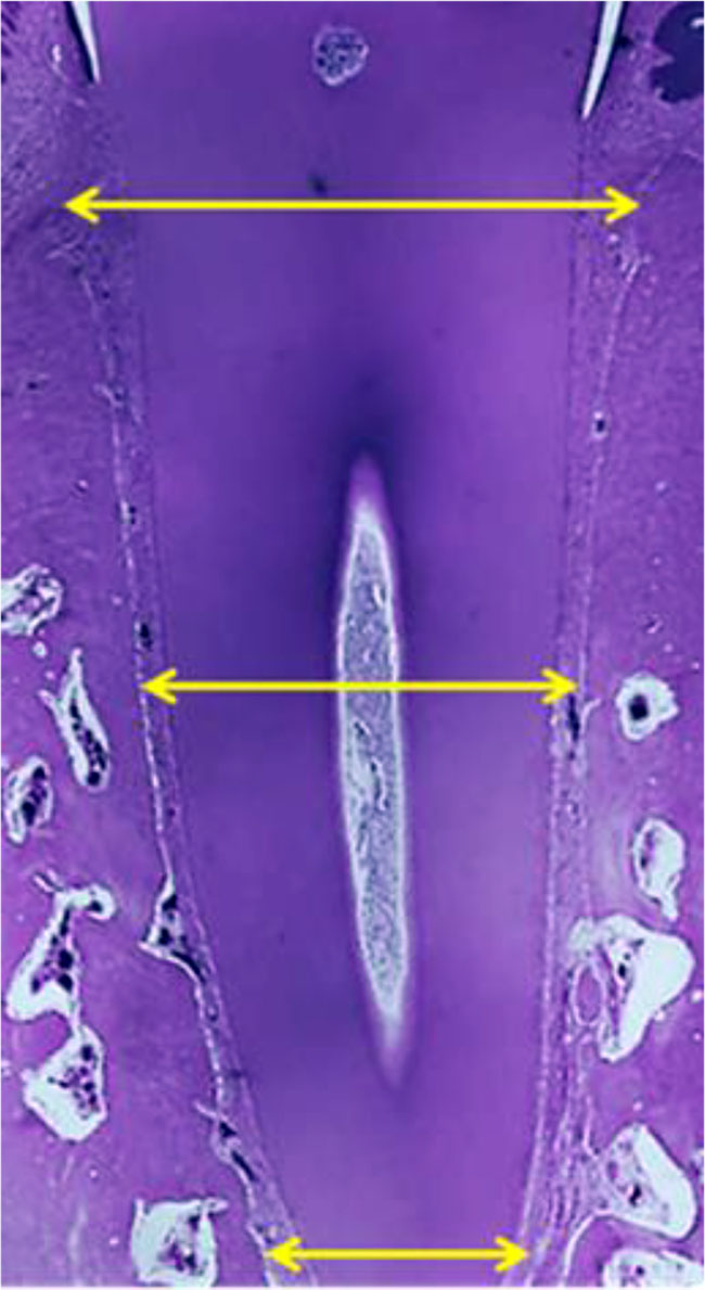 Figure 8. Histological sample of the maxillary segment of the maxillary central incisor with the root examination zones marked: gingival, middle, apical (×20, hematoxylin-eosin stain).