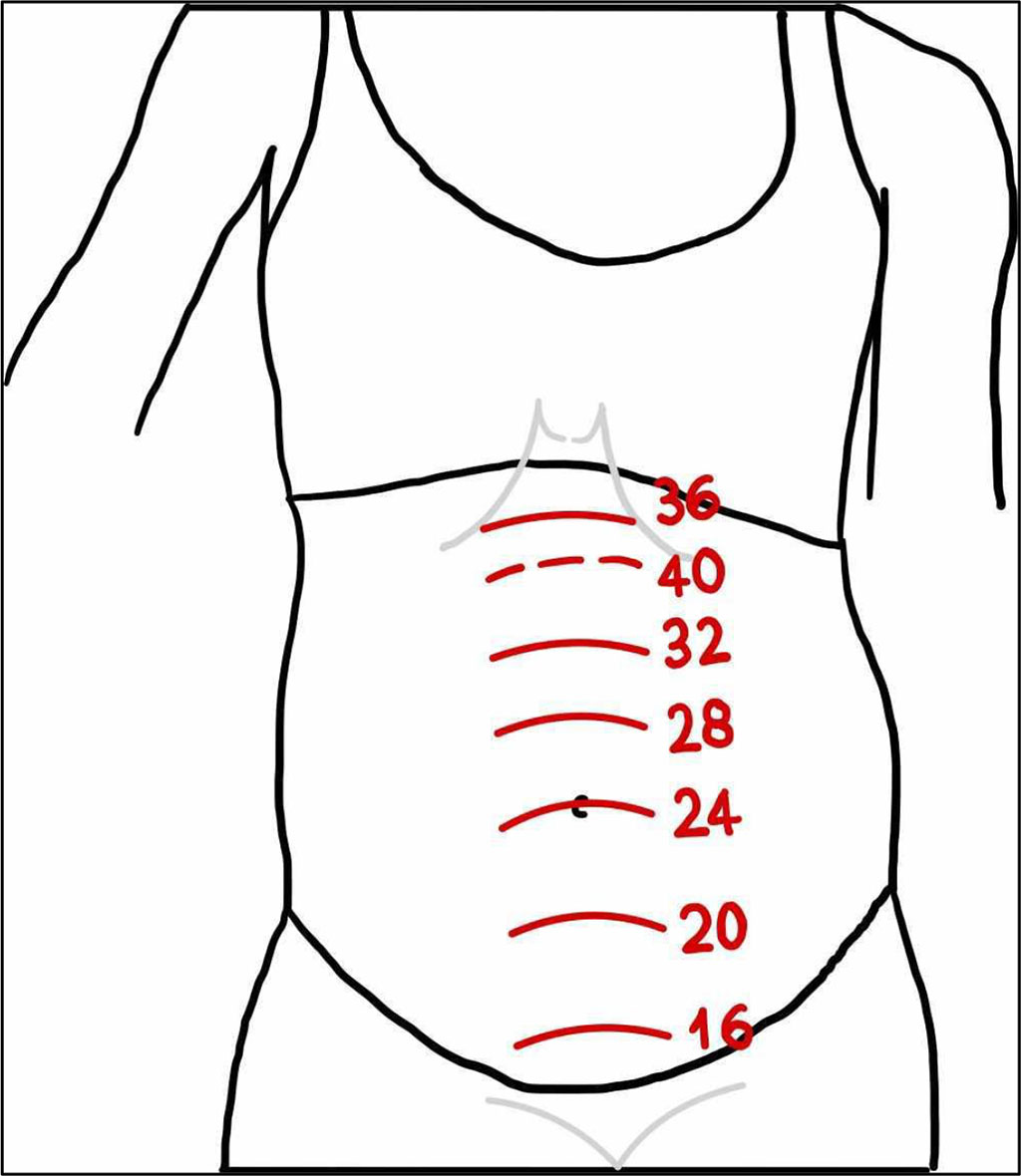 Figure 2. Height of the pregnant woman's fundus in relation to the duration of pregnancy [Authors' own figure].