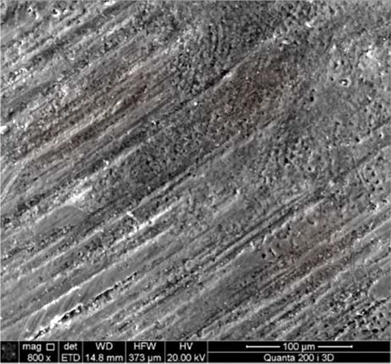 Figure 1 - The enamel surface of an intact tooth, SEM magnification 800