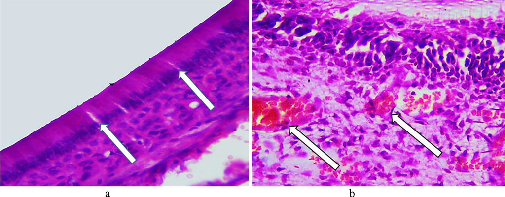 Fig. 14. Pathomorphological changes in the dental tissues, the main group rats, Day 16 of the experiment: a – signs of vacuole dystrophy affecting odontoblasts (×600, hematoxylin-eosin staining); b − multiple diapedetic microhemorrhagia (×800, hematoxylin-eosin staining).