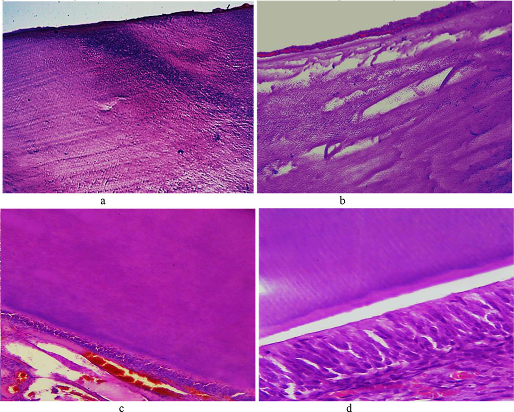 Fig. 15. Pathomorphological changes in the tooth enamel, the main group rats, Day 24 day of the experiment: a – disturbed structure of the enamel prisms appearing as dark blue areas in the enamel surface layers (×100, hematoxylin-eosin staining); b – local defects of the enamel surface featuring cavity foci of destruction in the subsurface layer (×200, staining with hematoxylin-eosin); c – unevenly erasing enamel prism pattern (×200, hematoxylin-eosin staining); d – unevenly erasing enamel prism pattern (×600, hematoxylin-eosin staining).