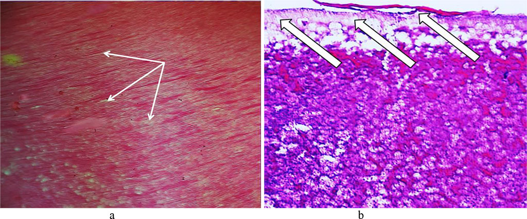 Fig. 18. Pathomorphological changes affecting the tooth enamel, the main group rats, Day 32 of the experiment: a – expanded interprism spaces (×200, hematoxylin-eosin staining); b – foci of disturbed integrity of the enamel surface layer (×400, hematoxylin-eosin staining).