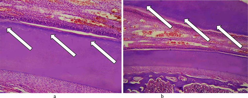 Fig. 19. Pathomorphological changes in the dentin, the main group rats, Day 32 of the experiment: a, b – expanded dentin tubules with cavities developing in the dentin (×200, hematoxylin-eosin staining).