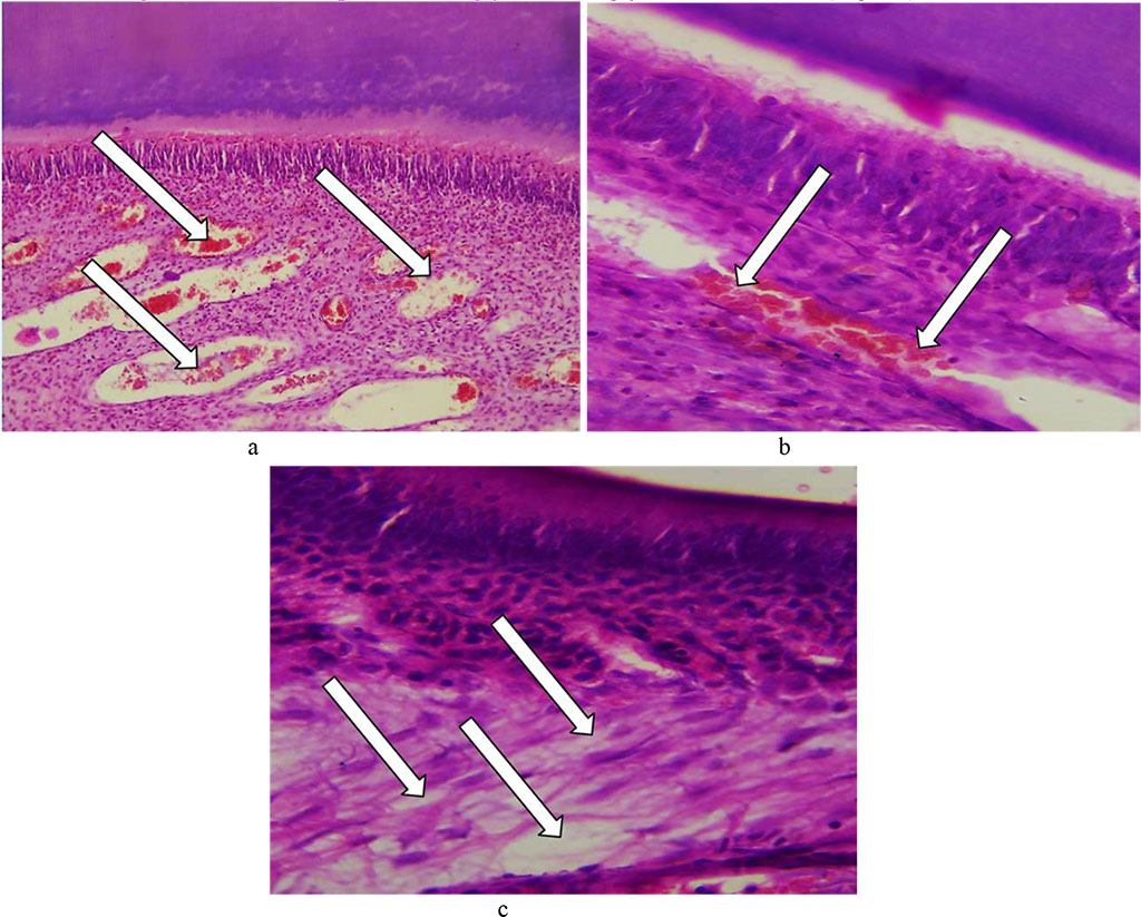 Fig. 23. Pathomorphological changes in the tooth pulp, the main group rats, Day 32 of the experiment: a – significant diffuse fullness and edema with cavities developing (×200, hematoxylin-eosin staining); b – stasis, fullness of vessels with diapedetic hemorrhages (×800, hematoxylin-eosin staining); c –edematous fluid accumulation in the perivascular spaces and between connective tissue fibers (×800, hematoxylin-eosin staining).