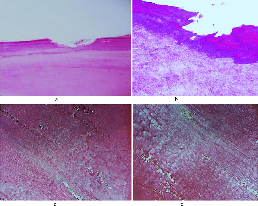 Fig. 24. Pathomorphological changes in the tooth enamel, the main group rats, Day 60 of the experiment: a – enamel surface defect manifested as erosion (×200, hematoxylin-eosin stain); b – enamel surface defect manifested as erosion (×400, hematoxylin-eosin stain); c, d – transverse striation of enamel prisms (×200, hematoxylin-eosin staining).