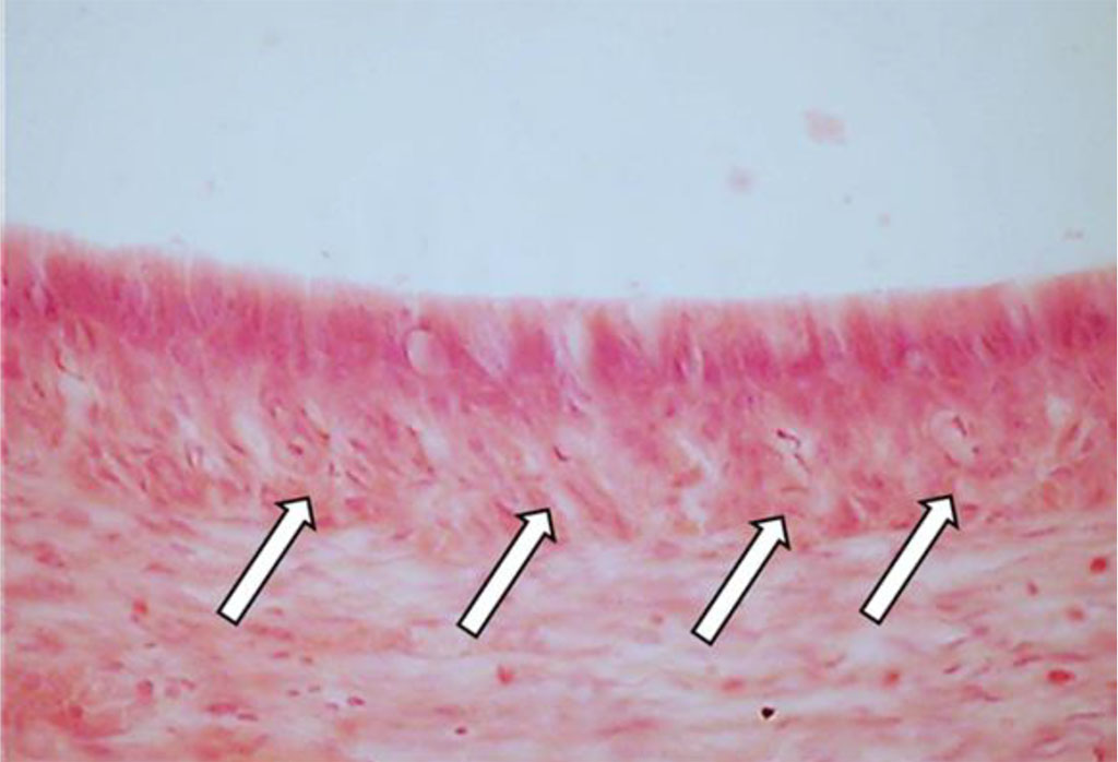 Fig. 25. Vacuole dystrophy of ameloblasts, the main group rats, Day 60 of the experiment (×800, hematoxylin-eosin staining).