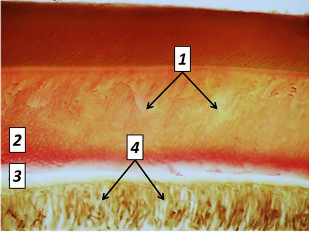 Fig. 27. Pathomorphological changes in the dental tissues, the main group rats, Day 60 of the experiment: 1– large foci of dentin demineralization; 2 – expansion of the predentin layer; 3 – accumulation of edematous fluid under the odontoblast layer; 4 – dystrophic changes of odontoblasts; (×800, Van Gieson picrofuxin staining).