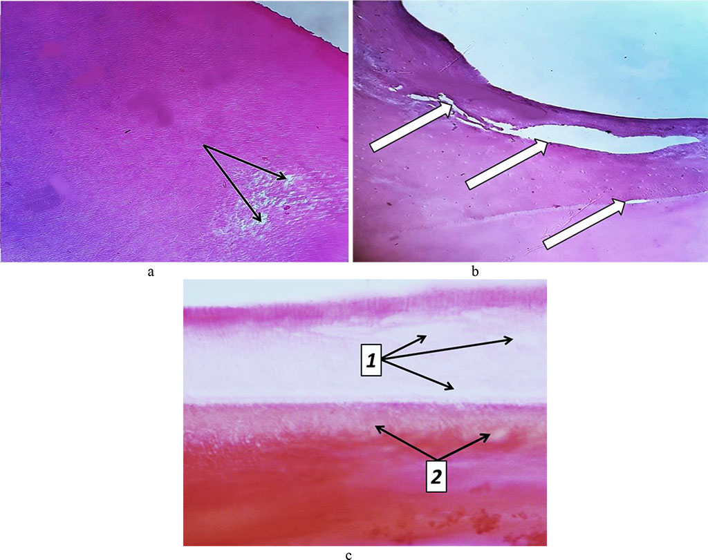 Fig. 28. Pathomorphological changes in tooth cement, the main group rats, Day 32 into the experiment: a – foci of tooth cement resorption (bright areas) (×200, hematoxylin-eosin staining); b – cavities in the tooth cement (×200, hematoxylin-eosin staining); c – foci of dental dentin resorption (1) and cement resorption (2) (×800, hematoxylin-eosin staining).