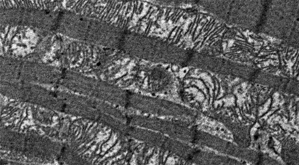 Figure 3. Histopathological changes in myofibrils of contractile cardiomyocytes: overt primary hypothyroidism on day 29 from the start of the experiment. Magnification 4200. TEM. 