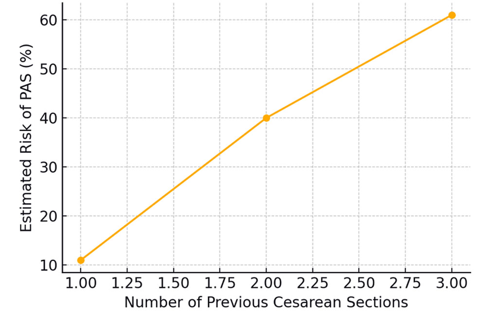 Figure 2. Risk of placenta accreta spectrum (PAS) occurrence depending on the number of previous cesarean sections.