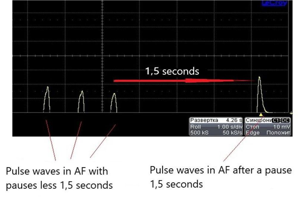 Figure 3. Data from oscilloscope connected with piezoelectric pressure probe in atrial fibrillation simulation (the biggest wave is registered after the pause for 1,5 seconds and more).