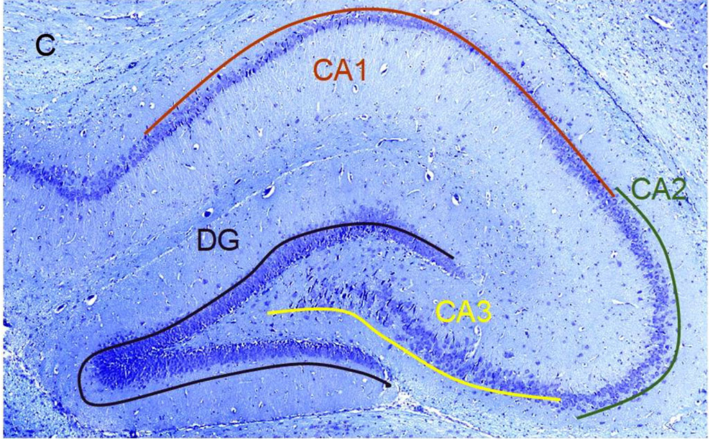 Figure 1. А. Scheme of the septoplasty simulation. Arrows indicate the direction of the nasal septum scarification. B. Location of the rat hippocampus subfields. Immunohistochemical reaction anti-p53. Staining with Mayer's hematoxylin. Magnification, х10. С. Location of the rat hippocampus subfields. Nissl staining. Magnification, х10