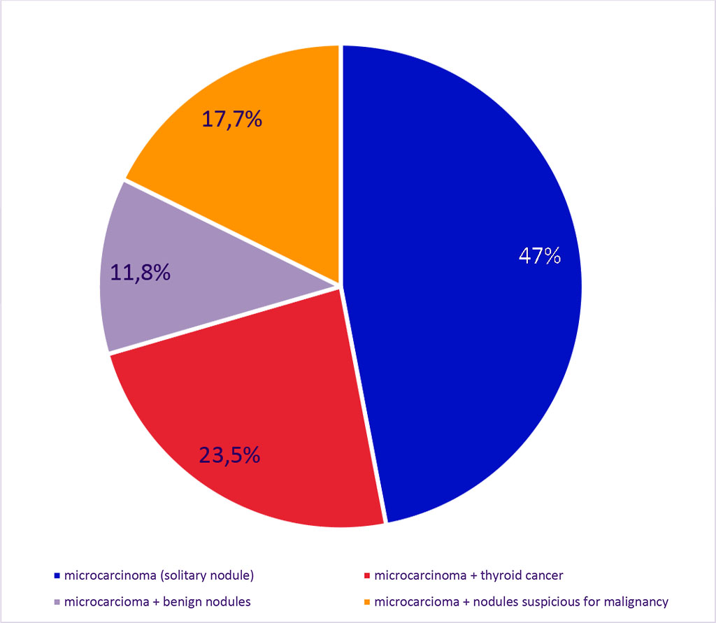 Figure 3. Structure of Micropapillary Carcinoma in Combination with Other Thyroid Nodules